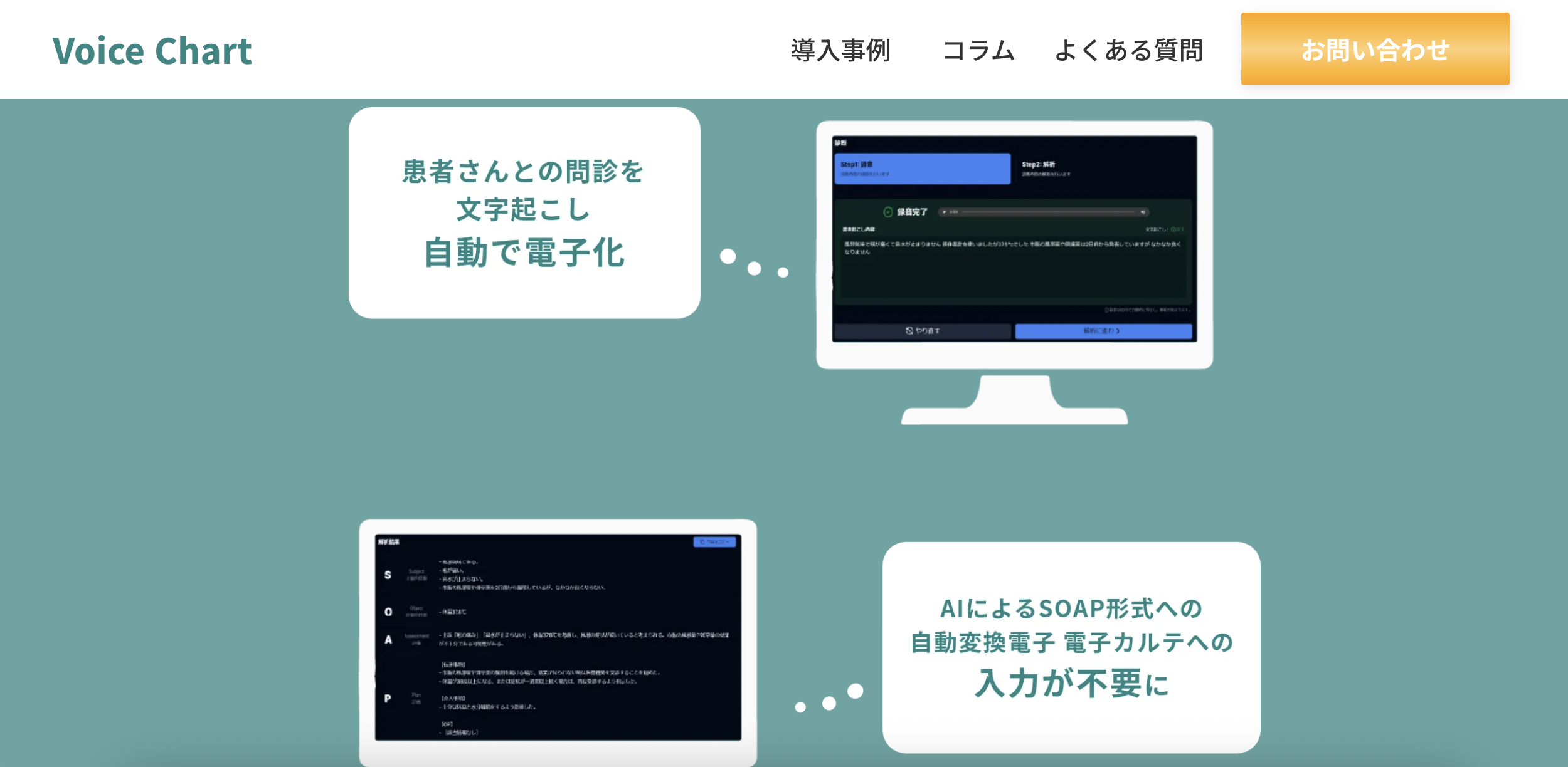 Voice ChartのUI画面